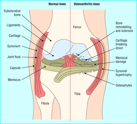 Knee  ditki medical and biological sciences